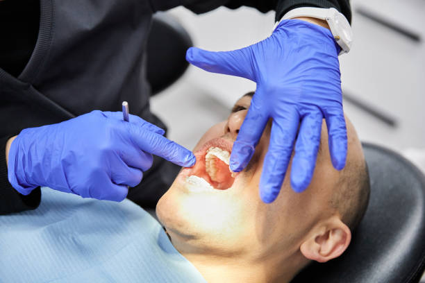 Best Broken or Chipped Tooth Repair in Hidden Hills, CA